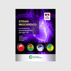 Strain miocárdico. La...